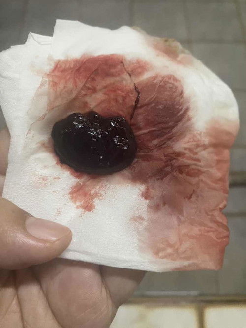 เเชร์ประสบการณ์