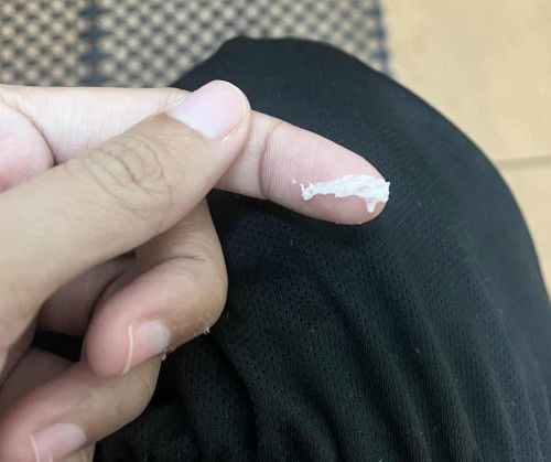 maaf kalau gambar ni rasa kotor tapi sy ingin tau ada ka keputihan saya ni teruk?