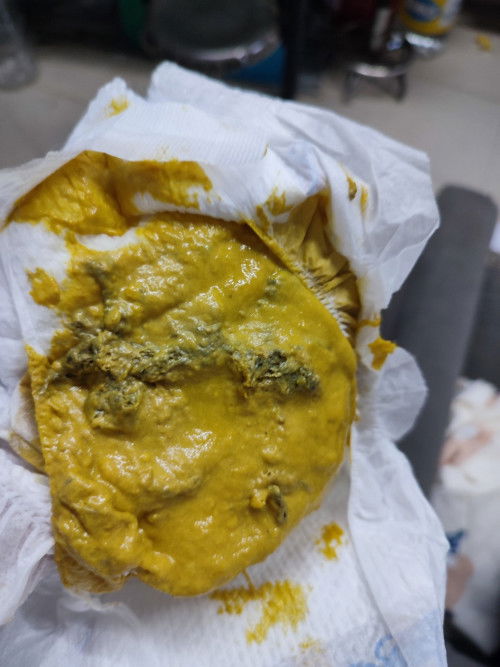 itim sa poops ni babay