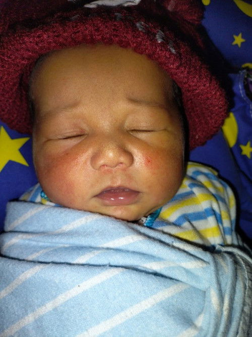 Bunda" Mau tanya anak qw baru lahir ada 6 hari trus di wajah nya muncul merah" Knpa ya bunda