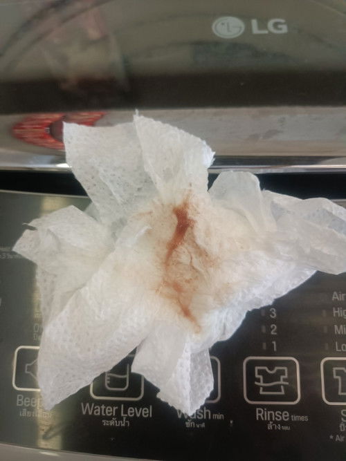 ครรภ์ 38+6 week