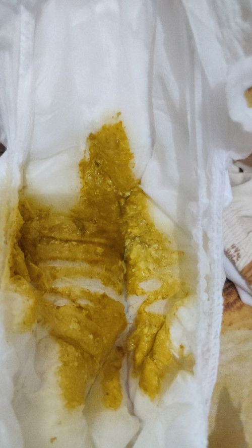 Pup bayi 4bulan 5hari