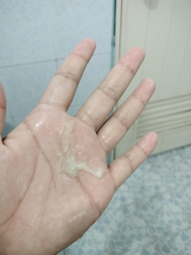 อายุครรภ์ 36+6