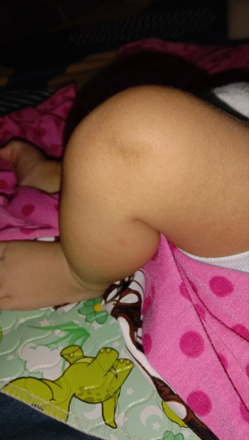 bentuk lutut bayi