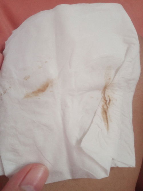 สอบถามค่ะ.