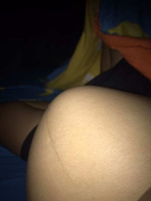 หายใจไม่สะดวก 33w6d