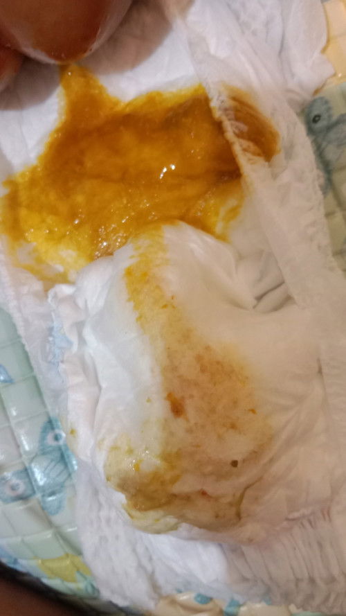 ⚠️⚠️⚠️ YG JIJIK AN ATAU YG LAGI MAKAN SKIP YA MOM!