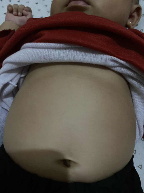 Ini cekung ga si bun?