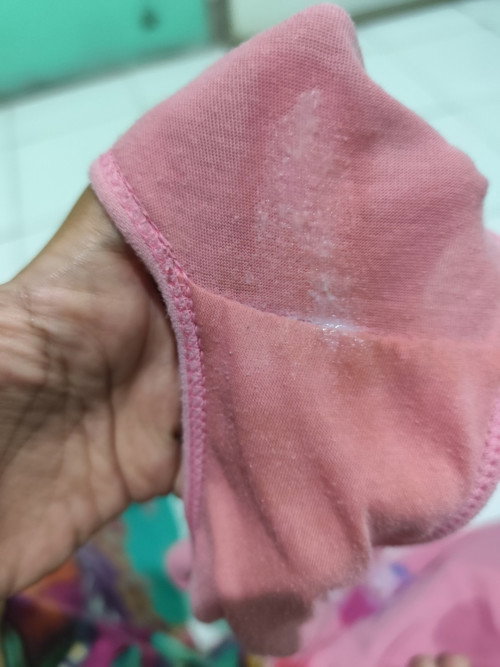 Keluar cairan di usia 38week
