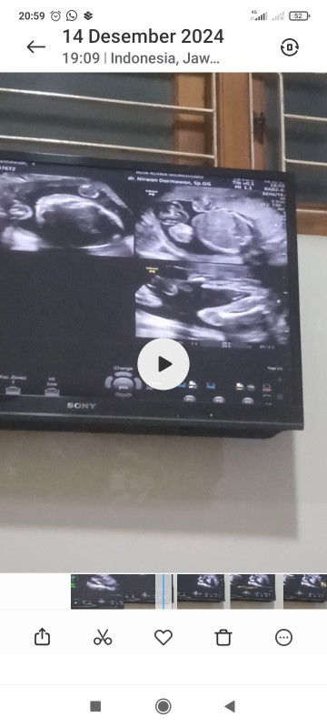 hasil usg cewek,,