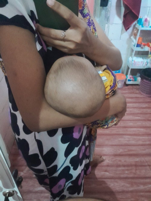 Cara mengatasi Kepala peyang