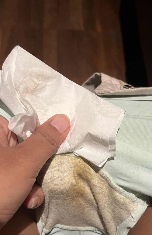 Flek cokelat sedikit apakah aman?