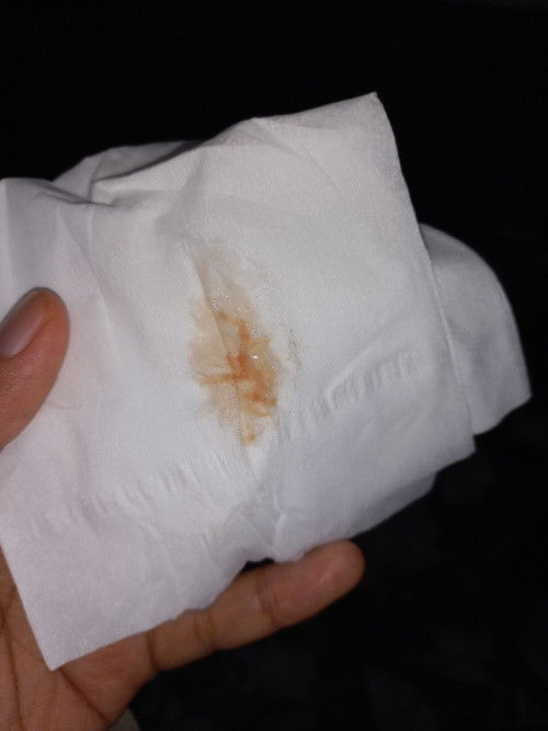 Flek coklat di 8 minggu 4 hari