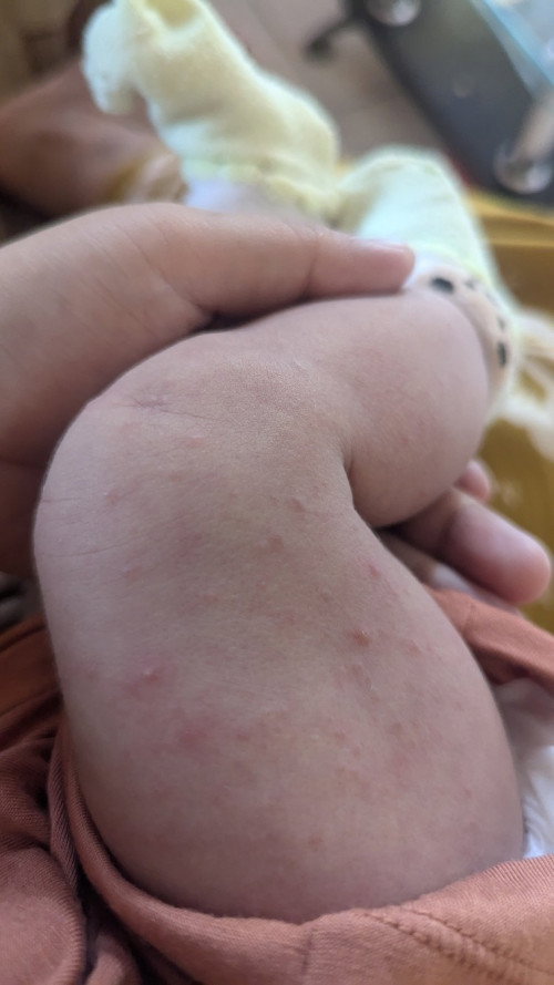 Bintik merah di kaki