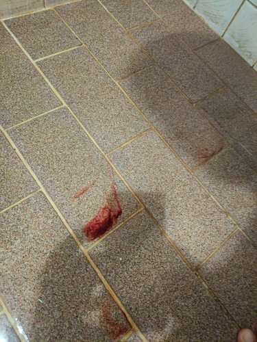 มีเลือดออกขณะตั้งครรภ์?