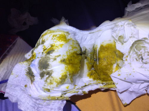 Pup bayi wrna kuning+hijau ke abuabuan pekat