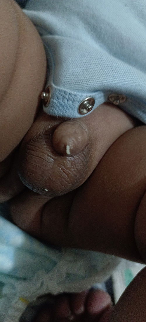 Paramg discharge sa baby boy