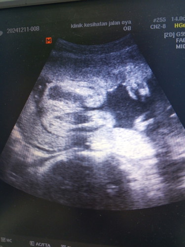 Jantina baby lelaki atau perempuan