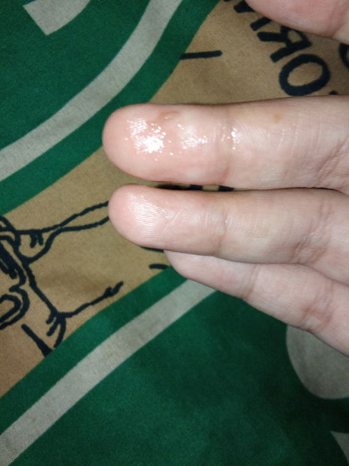 Maaf jorok sebelum nya saya hamil 37 Minggu tiba tiba keluar lendir coklat tapi sedikit kenapa ya?