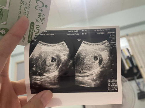 ไม่เจอตัวน้อง?