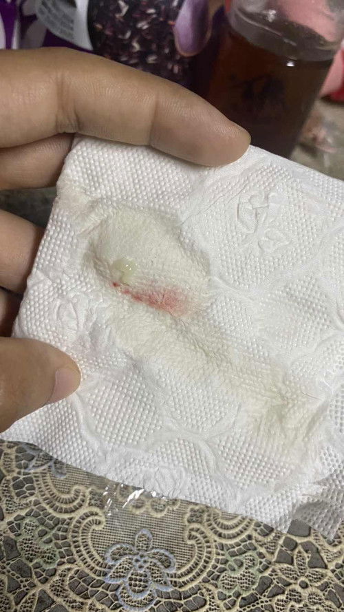 ท้องแรก39สัปดาห์