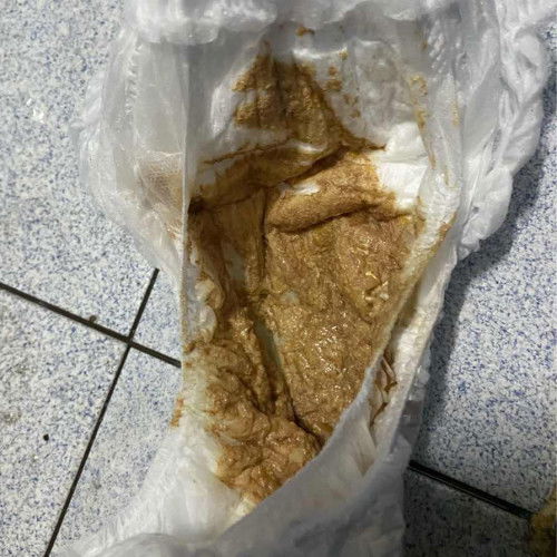 แบบนี้ปกติมั้ยคะ