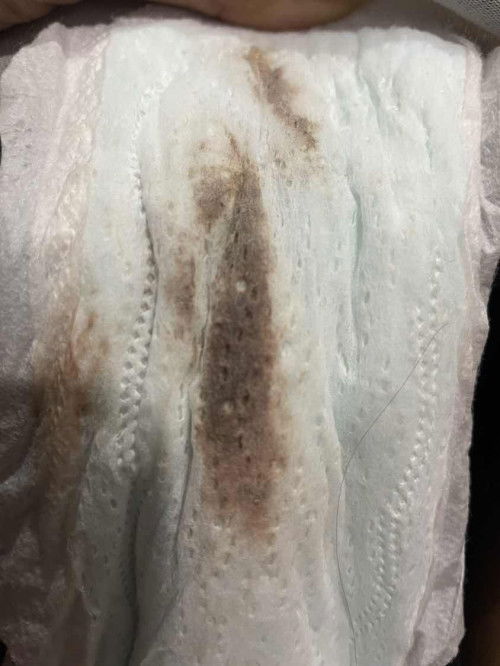 พอดีฝั่งยาคุมได้1ปี2เดือน