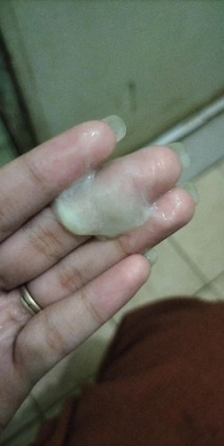 discharge po ba ito?