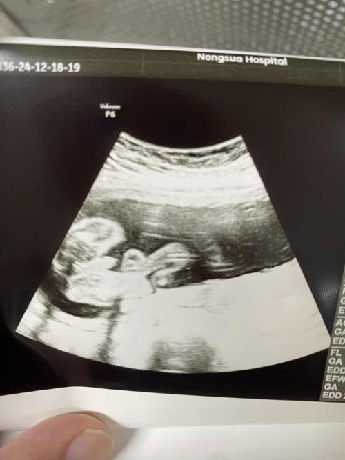 แม่ๆว่าผู้ชายมั้ยค่ะ😂😂