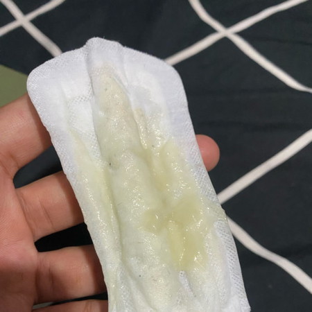 แบบนี้เกิดจากอะไรคะ