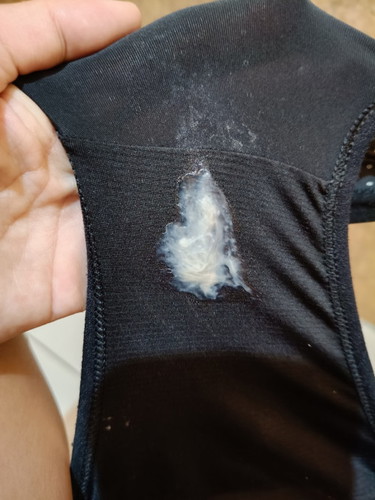 MUCOS O DISCHARGE?