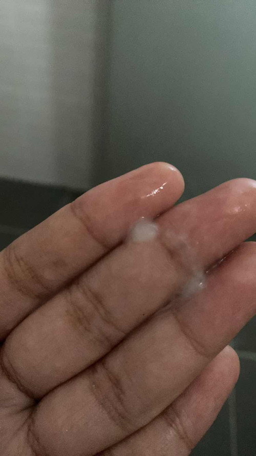 แบบนี้อีกนานไหมคะจะคลอด