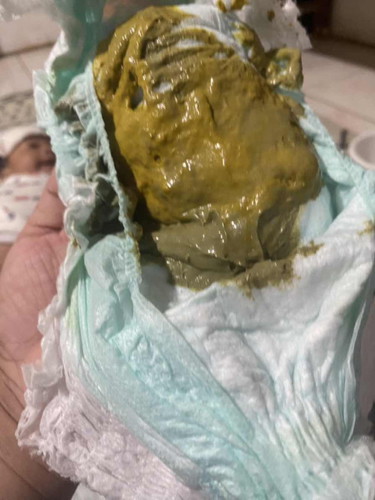 Poop color