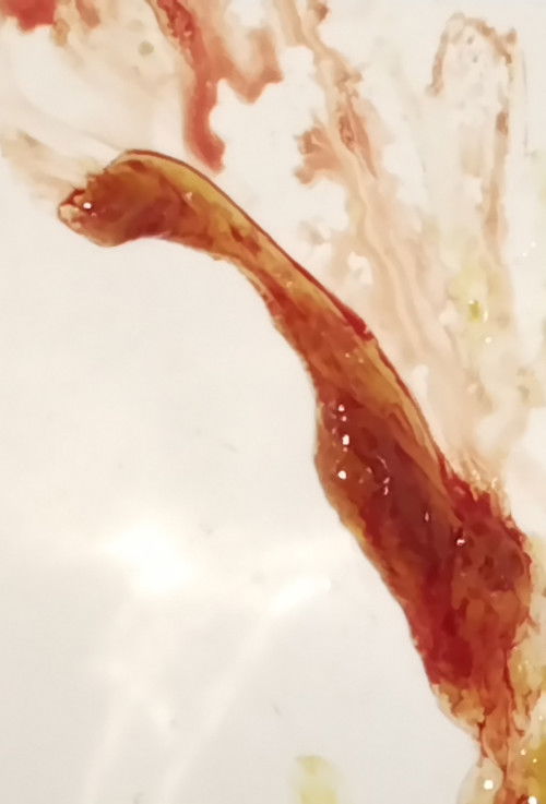 ถ่ายออกมาเป็นมูกเลือด