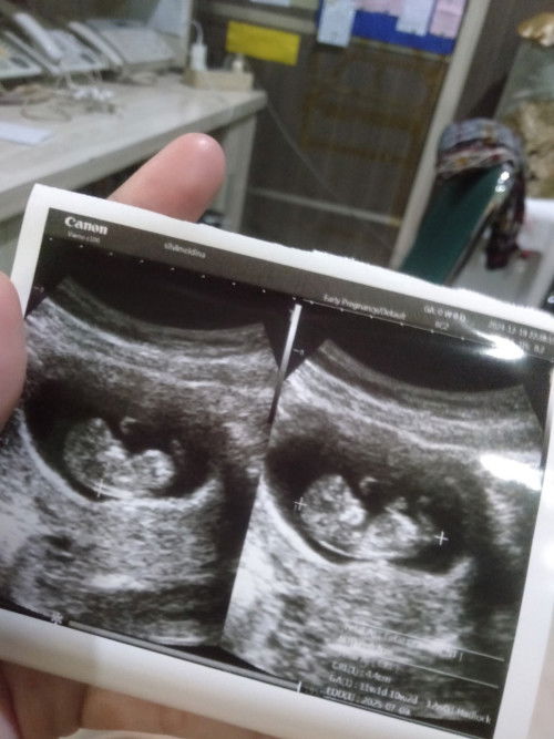 11w1d sayang ibu bapak berjuang samasama ya sayang🤗🤲
#masyaAllahTabarakallah