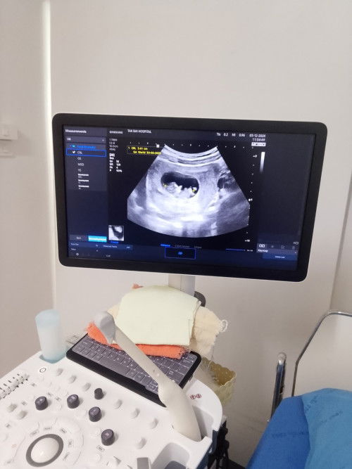 แม่ไปเซาว์น้องตอนกี่วีค? กันคะ