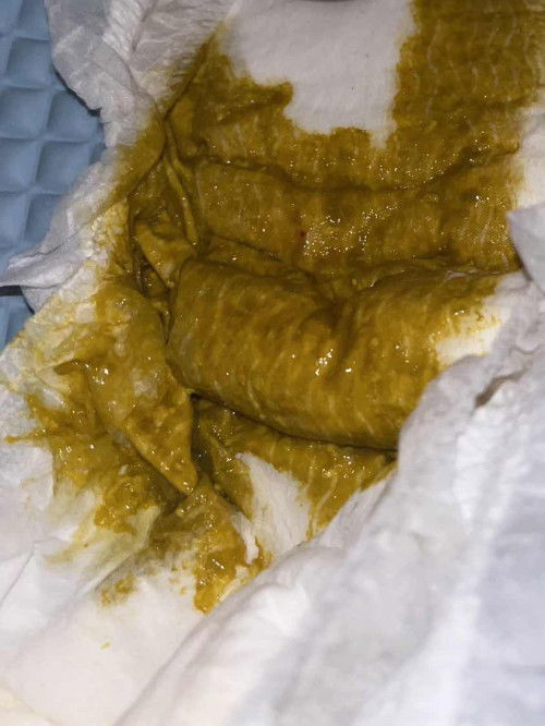 Najis bayi 3 bulan ada setompok darah merah