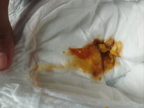 Bab bayi encer kuning ada bercak darah