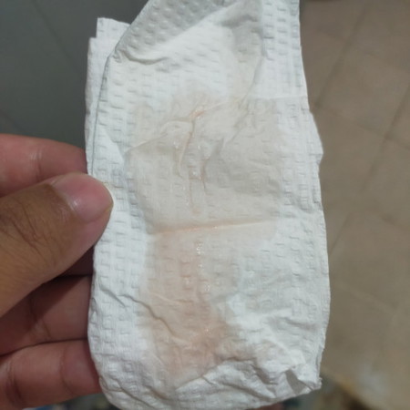 หลังจากการกระตุ้น