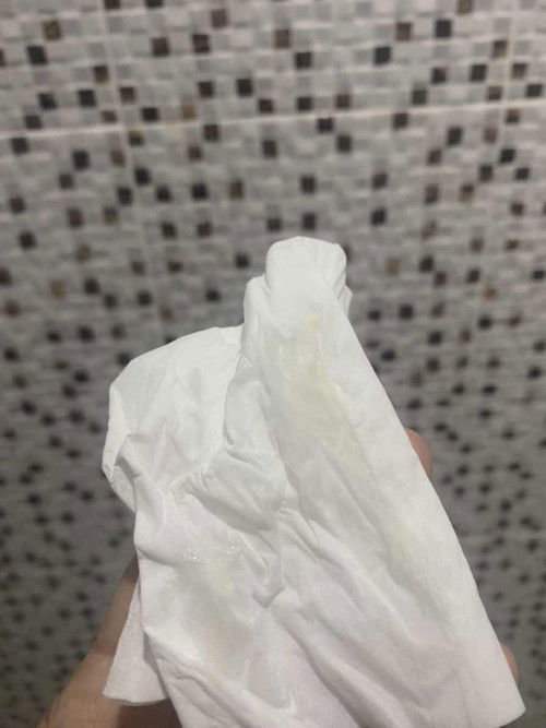 ปกติเราตกขาวจะเป็นเนื้อแป้งขุ่นๆขาวๆ แต่อันนี้ยืดๆ ขาวปนเหลือง ก้อนนิ่มๆเหมือนเยลลี่ เป็นตกขาวหรือมูกคะ 38+3