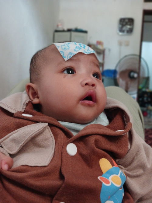 Tanda lahir bahaya ga sih