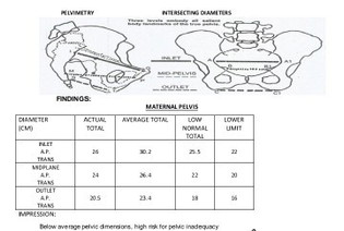 Pelvimetry X-ray