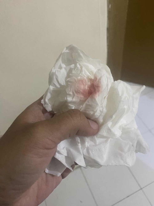 Pengalaman pertama di kehamilan anak ke 2