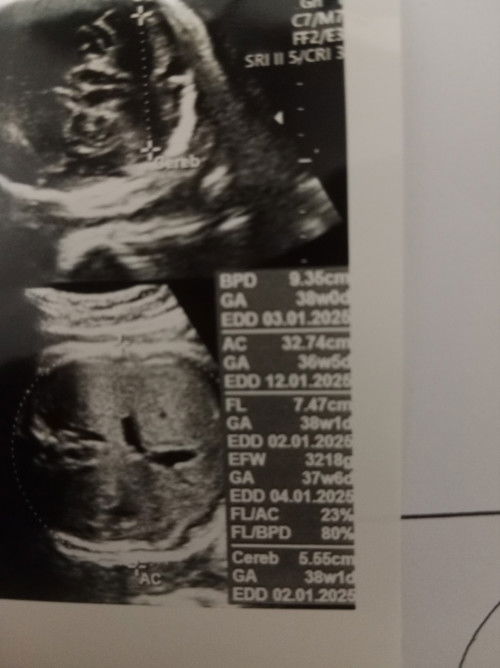 Bun tanya dong hpht 13 maret 2024 itu hplnya desember apa Januari ya?