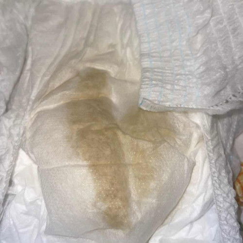 Kehamilan 35 minggu 4 hari semalam keluar cairan ini