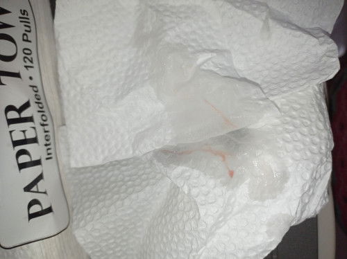 MUCUS NA PO BA ITO MGA MHIE?