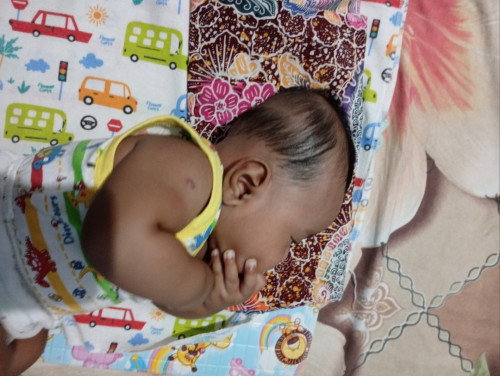 Kepala bayi lonjong