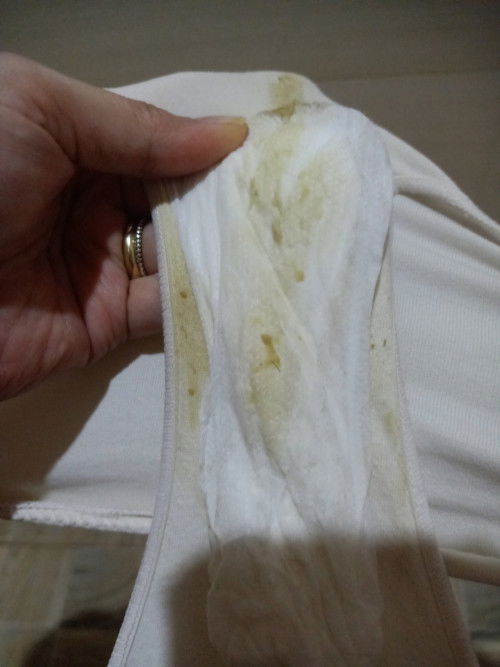 Discharge Yellow slight green