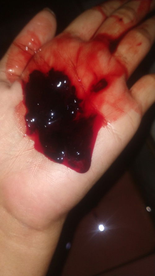 Klo seperti itu janin bukan bun?