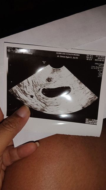 9week vonis suspect BO